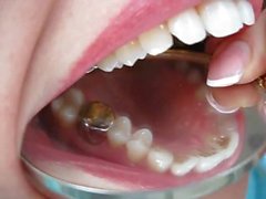 nice zoom on spitty mouth, gold crown mmmm