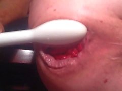 anal insertion prolapse ass gaping huge asshole