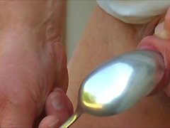 Large metal spoon with foreskin - 7 more videos